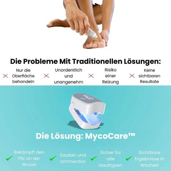MycoCare™ - Laser-Nagelpilz-Behandlung Gerät