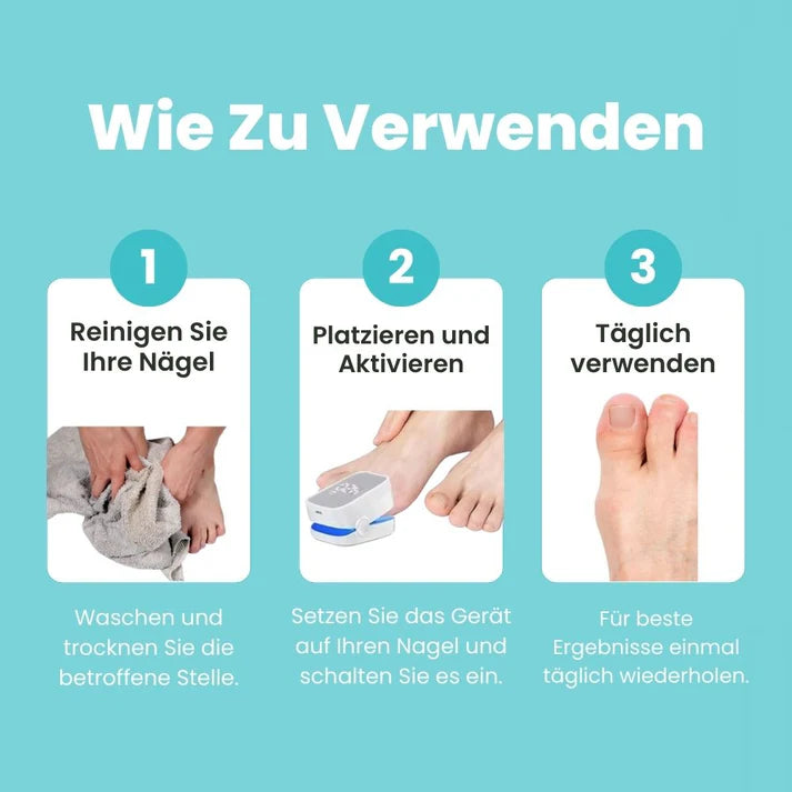 MycoCare™ - Laser-Nagelpilz-Behandlung Gerät