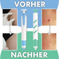 Novasta Warzenfrei PRO - Der Professionelle Stielwarzen Entferner